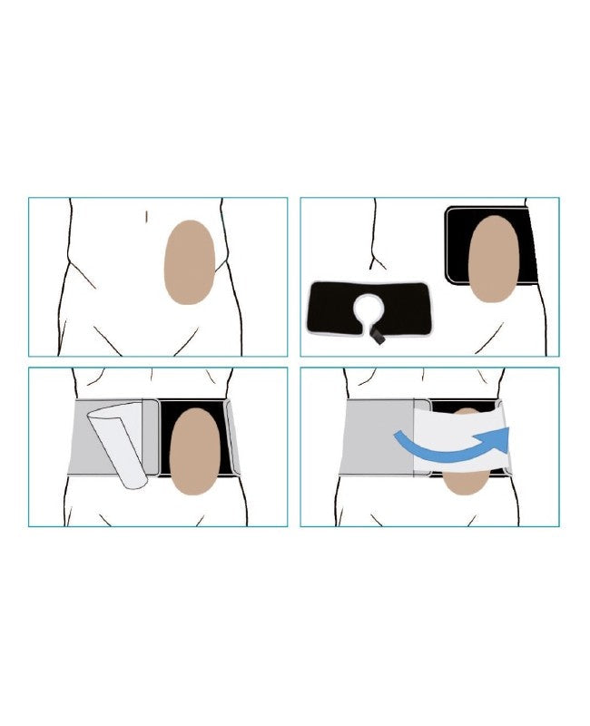 Cintura Fascia per stomizzati Orione Ref.3052 Altezza 16 cm.